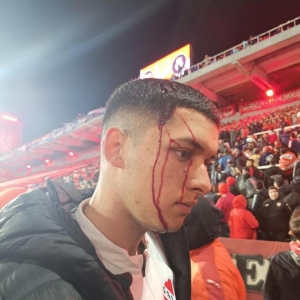 南球杯1/8决赛，智利球迷与阿根廷球迷发作辩论导致角逐停息 ...